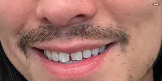 4 (1) -res 4 (1) -res