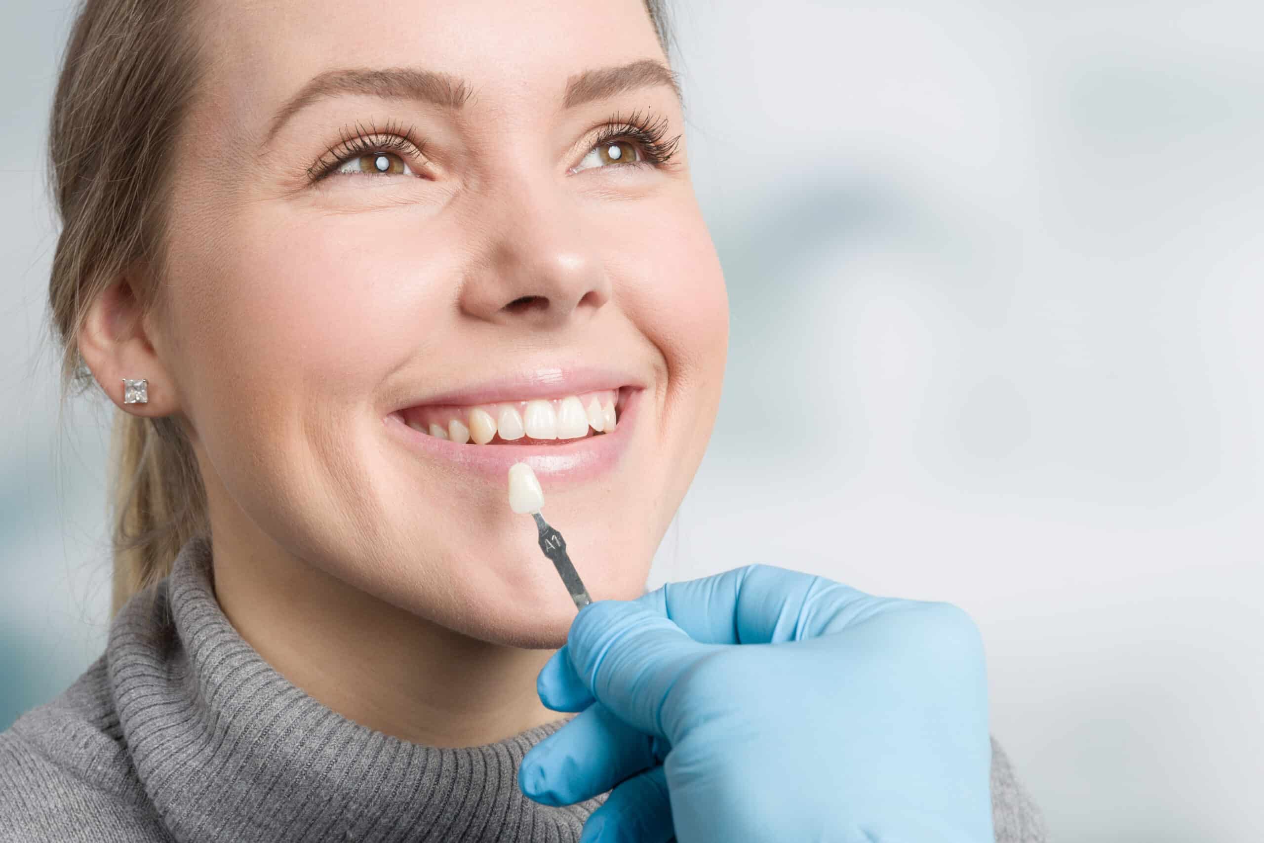 Close-up of a patient receiving Day Crowns in Novato at a modern dental clinic.